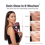 ULTIMA Facemask – LED Lichttherapie Maske mit 4 Wellenlängen